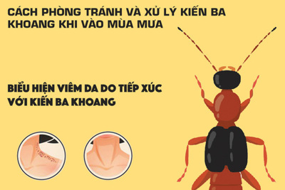 [Infographics] Mẹo phòng tránh và xử trí kiến ba khoang khi vào mùa mưa