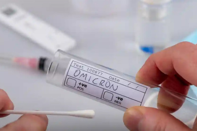 Thủ tướng Chính phủ yêu cầu thông tin chính thức, công khai về kit xét nghiệm