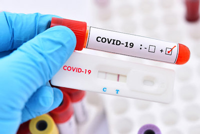 Tạm dừng yêu cầu phải xét nghiệm virus SARS-CoV-2 trước khi nhập cảnh vào Việt Nam