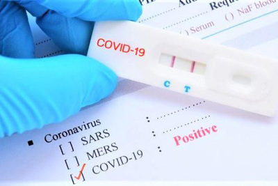 Cần lưu ý gì khi sử dụng test nhanh để xác định F0 và tình trạng khỏi bệnh?