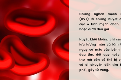 Những thực phẩm giúp ngừa chứng nghẽn mạch máu nguy hiểm
