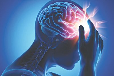 Những điều cần biết về đột quỵ