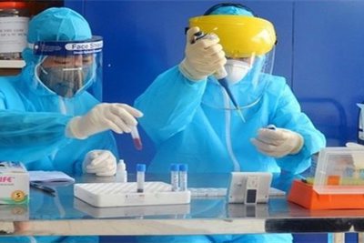 Đề xuất mức giá dịch vụ test nhanh SARS-CoV-2 không quá 80.600 đồng/xét nghiệm