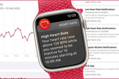 Apple Watch phát hiện được các triệu chứng về tuyến giáp?