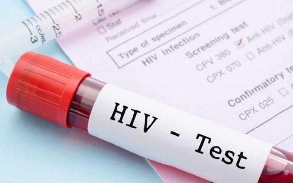 Đa dạng hóa dịch vụ tư vấn và xét nghiệm HIV.